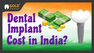 Cost of Dental Implant in India dental implant cost india  dental implants cost in india [upl. by Cornwall]