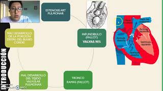 Estenosis de la Arteria Pulmonar [upl. by Nanine]