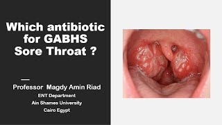 Which Antibiotic for Sore Throat [upl. by Aryahay]