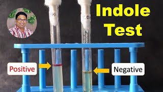 Bacterial Identification Tests Indole Test [upl. by Zohara]