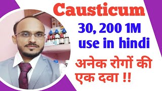 Causticum 30 200 1M use in hindi Causticum homeopathic medicine use amp symptoms causticum for warts [upl. by Hogg393]