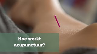 Hoe werkt acupunctuur [upl. by Remos]