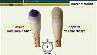 Oxidase Test Five Methods [upl. by Ahilam]