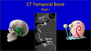 CT Temporal Bone Made Easy Part 1  Step by Step Approach [upl. by Bunnie]