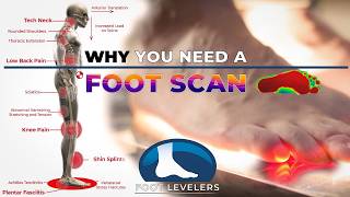 Correcting pronation leads to whole body health benefits Why you need a foot scan [upl. by Nolyak]