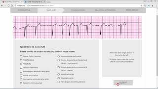 ACLS Precourse ECG Rhythm [upl. by Telford]