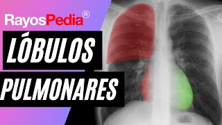 Esquematización de los lóbulos pulmonares  Rx de Tórax [upl. by Mlehliw660]