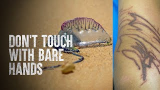 How to Survive a Portuguese Man O War [upl. by Drusi]