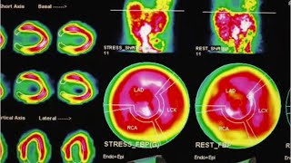 Nuclear Medicine Technologists Career Video [upl. by Bluhm]