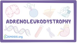 Adrenoleukodystrophy  causes symptoms diagnosis treatment pathology [upl. by Hernardo]