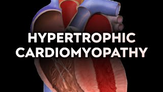 Hypertrophic Cardiomyopathy HCM [upl. by Adnyl]