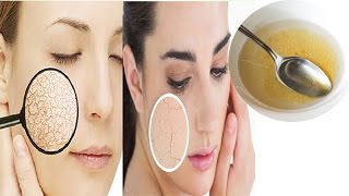 How to Get Rid of Dry Skin in Winters । Dry Skin Care Tips Cracked Skin Home Remedies [upl. by Zarah]