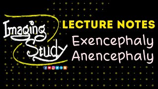 Exencephaly  Anencephaly Imaging Study Lecture [upl. by Siri910]