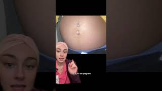 Belly button piercings in pregnancy 🤰 pregnancy nurse postpartumperiod labouranddelivery [upl. by Freud209]