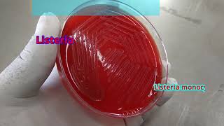 Listeria on blood agar [upl. by Pacificia]