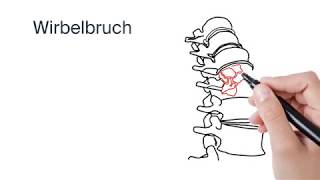 Behandlung Wirbelbruch by ATOS Kliniken [upl. by Ahsakat]