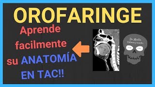 🔴Anatomía OROFARINGE en TOMOGRAFÍA [upl. by Darra]