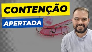 Contenção Odontológica APERTADA [upl. by Balbinder]