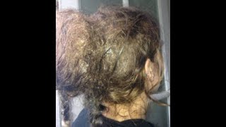 How To Detangle Severely Matted Hair Without Cutting  How To Detangle Badly Matted Hair At Home [upl. by Ahsatal]