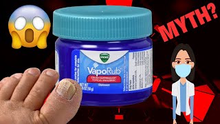 amazing uses and benefits of Vicks VapoRub [upl. by Nnaecarg291]