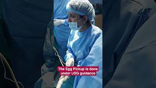 Egg pickup or ovum pickup is done to collect the female’s eggs for IVF treatment [upl. by Baxie]