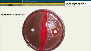 Bacitracin test for Streptococcus pyogenes [upl. by Pinter361]