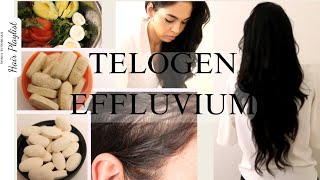 HOW I AM DEALING WITH TELOGEN EFFLUVIUM [upl. by Beryle]