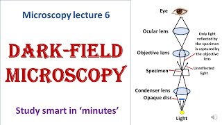 Darkfield microscope  working principle  Advantages disadvantages  Microscopy lecture 6 [upl. by Kelbee]