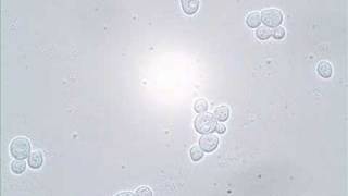 Budding and Shmooing  Yeast Reproduction [upl. by Lieberman]