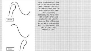 Condylar Vertical Dimension [upl. by Ib]