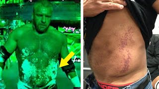 10 Worst WWE Wrestlemania Injuries [upl. by Dannie701]