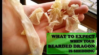 What to Expect When Your Bearded Dragon is Shedding [upl. by Haerdna679]