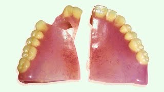 How to Apply Denture Adhesive or Denture Glue [upl. by Bowyer]