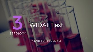 Widal test [upl. by Amled]