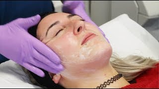 Image Perfection Peel with Elizabeth  The Laser and Skin Clinic [upl. by Ceil]