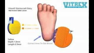 VITREX® STERIHEEL® Baby Safety Lancet [upl. by Mortie]