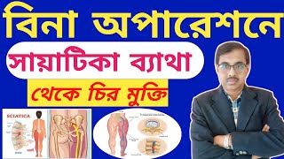 সায়েটিকা রোগ অপারেশন ছাড়াই কি ভাবে সুস্থ হবেন Sciatica Dr Tarun Mondal [upl. by Steward]