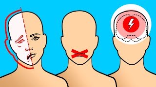 6 Señales que advierten sobre la proximidad de un derrame cerebral [upl. by Eninnaej512]