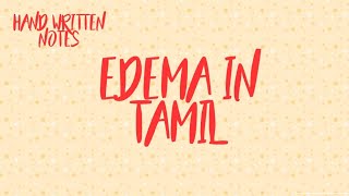 EDEMA IN TAMILHAND WRITTEN NOTES PATHOLOGY [upl. by Sampson298]