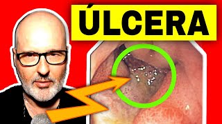 ÚLCERA GÁSTRICA o DUODENAL Síntomas Causas y Tratamiento [upl. by Smail422]