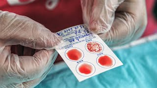 How to Test Your Blood Type at Home [upl. by Telrats]