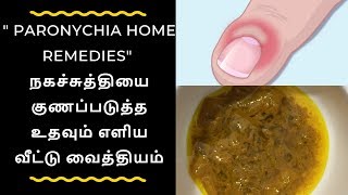 Paronychia Home Remedies  Naga Suthi Patti Vaithiyam Tamil  Naga Suthi Home Remedies In Tamil [upl. by Anikas]