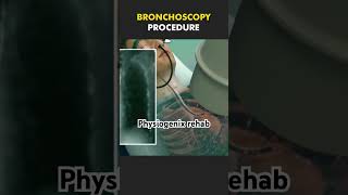 Bronchoscopy procedure shortsviral youtubeshort shortsfeed shortsyoutube youtubevideo youtuber [upl. by Aerda126]