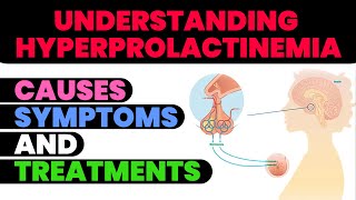 Understanding Hyperprolactinemia Causes Symptoms and Treatments [upl. by Salaidh]