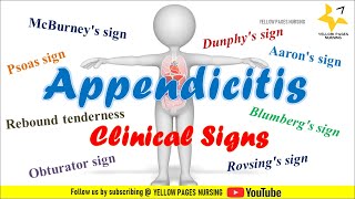 Clinical signs of Appendicitis  NCLEX REVIEW [upl. by Yvaht207]