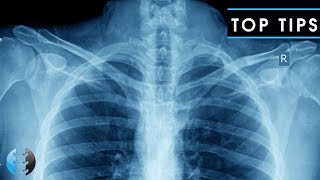 How to Read and Interpret Chest XRays OUR TOP 10 TIPS [upl. by Amyaj]