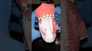 Dentist Reveals TOP 3 Reasons You Have BAD Breath 🤢🦷 [upl. by Emerick148]