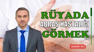 Rüyada Abraş Hastalığı Görmek [upl. by Helbonnas898]