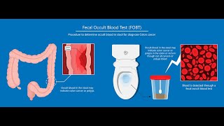 Guaiac Test or Fecal Occult blood test  Definition Purpose Uses Procedure Interpretation [upl. by Akienat]