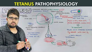 Tetanus Causes Symptoms Prevention and Treatment Biology lecture [upl. by Beeson577]